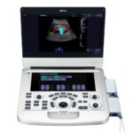 Ecógrafo Portátil Edan Acclarix AX3 3D/4D