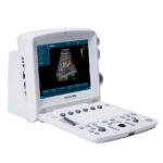 Ecógrafo portátil EDAN U50 - Imagen 4