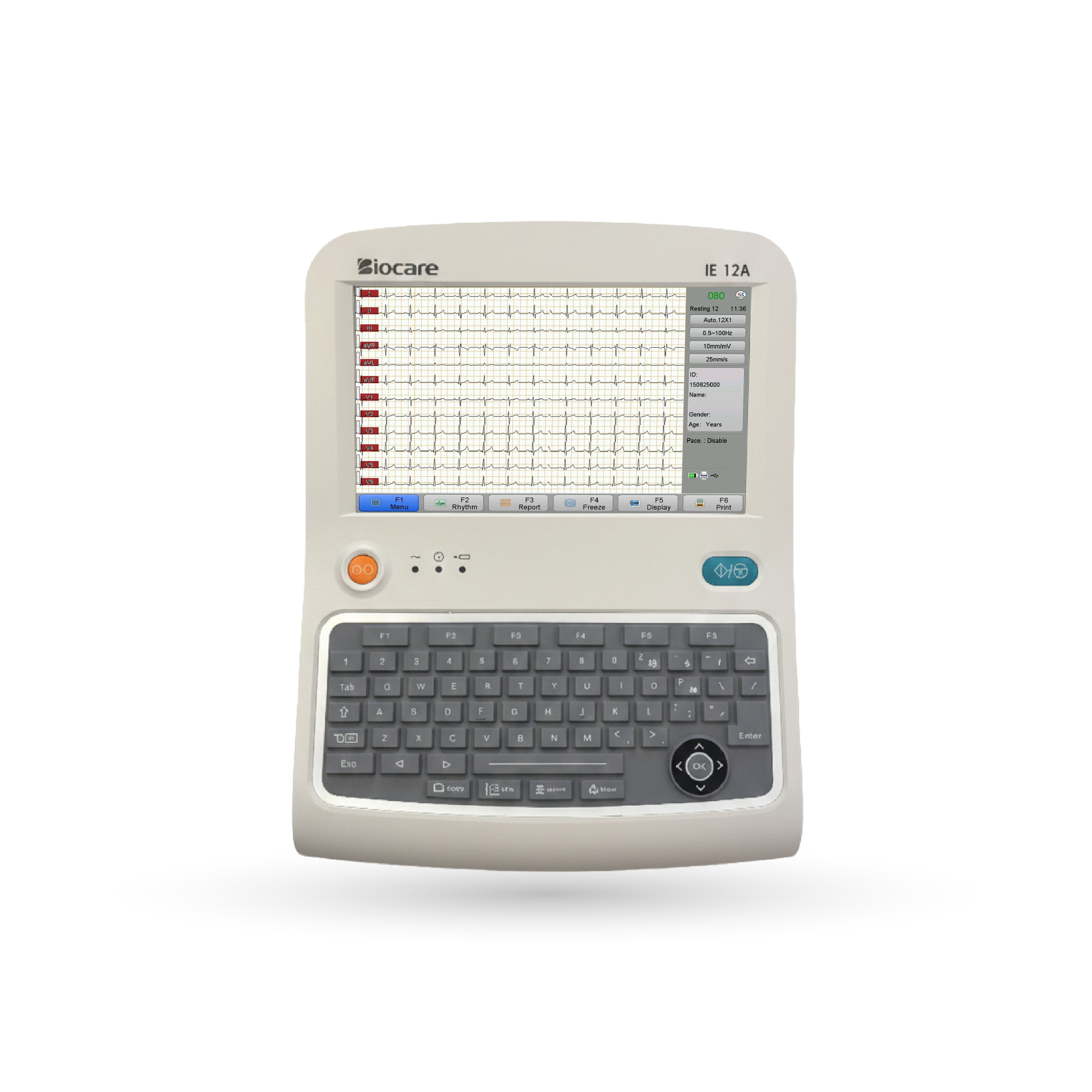 ie12a.1 Electrocardiógrafo Biocare IE-12A – 12 Canales - Imagen 1