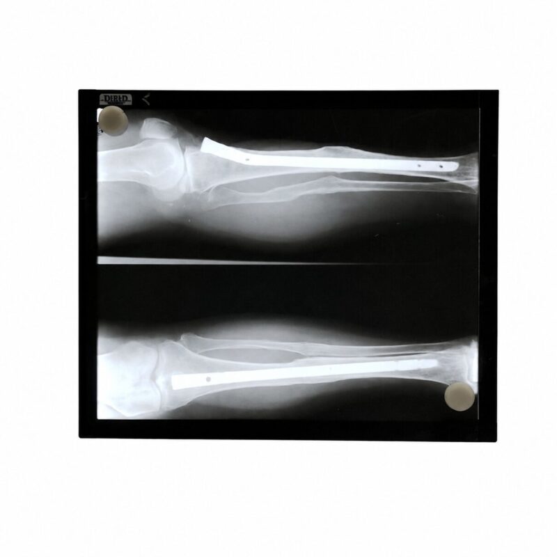 Negatoscopio LED Ultra Slim 24 x 28 cm