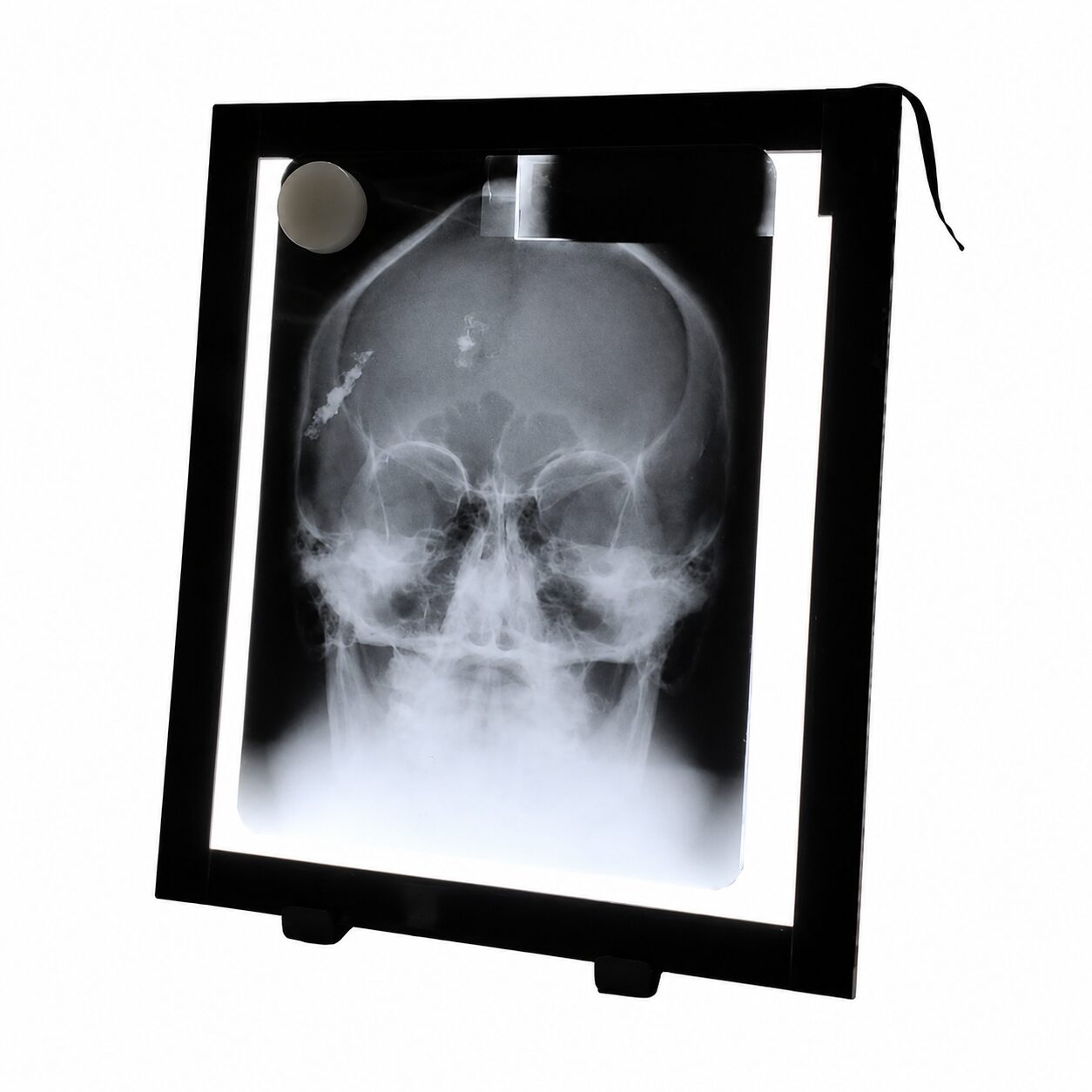 NEGATOSCOPIO.3 Negatoscopio LED Ultra Slim 38 x 46 cm - Imagen 1